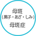 母斑 母斑症 (黒子・あざ・しみ)
